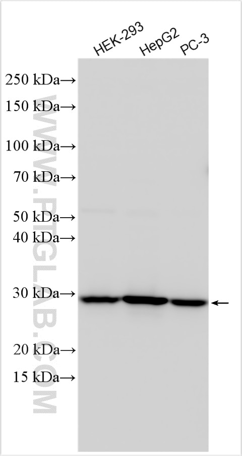 Western Blot (WB) analysis of various lysates using SLC25A10 Polyclonal antibody (12086-1-AP)