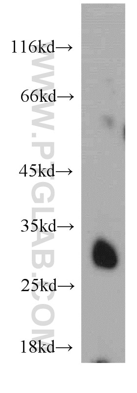 Western Blot (WB) analysis of mouse liver tissue using SLC25A10 Polyclonal antibody (12086-1-AP)