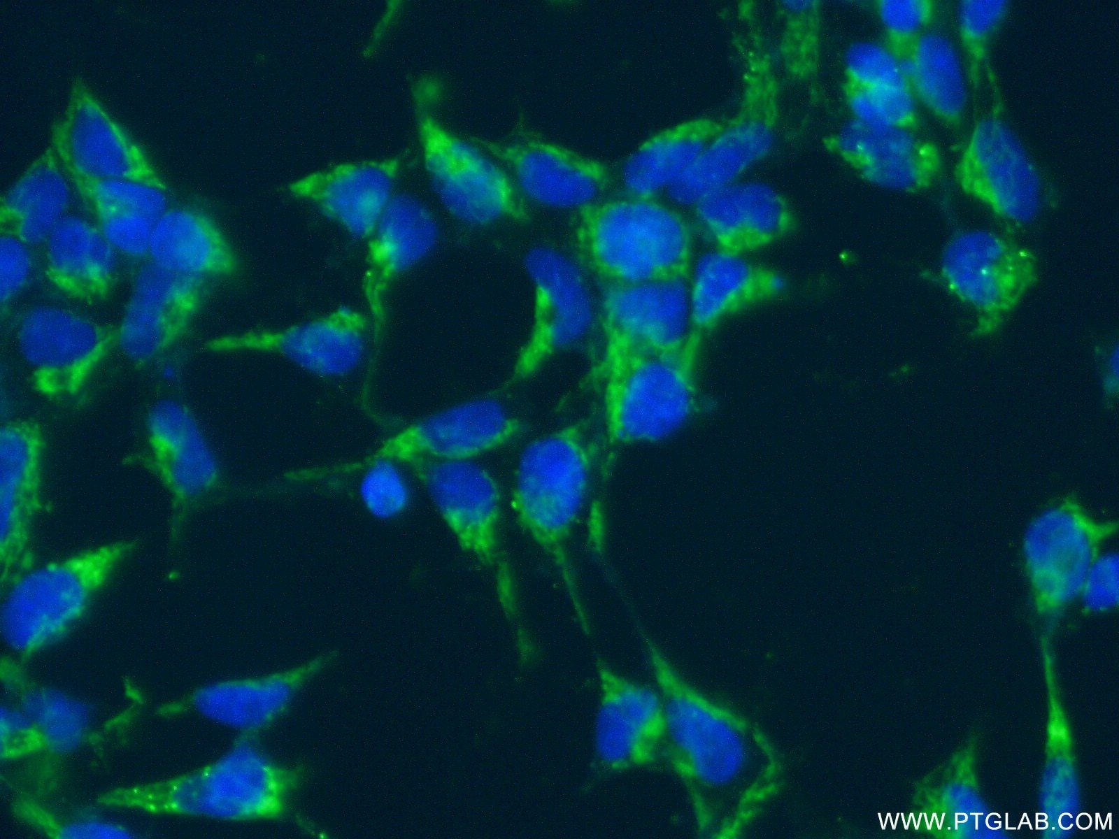 Immunofluorescence (IF) / fluorescent staining of HEK-293 cells using SLC25A11 Polyclonal antibody (12253-1-AP)