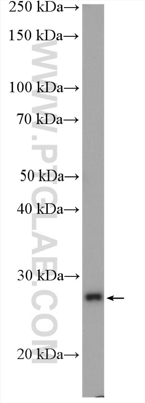 Western Blot (WB) analysis of HEK-293 cells using SLC25A11 Polyclonal antibody (12253-1-AP)