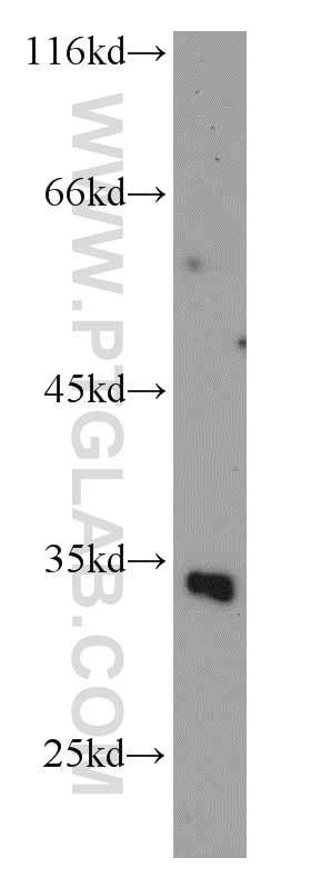 Western Blot (WB) analysis of human kidney tissue using SLC25A11 Polyclonal antibody (12253-1-AP)