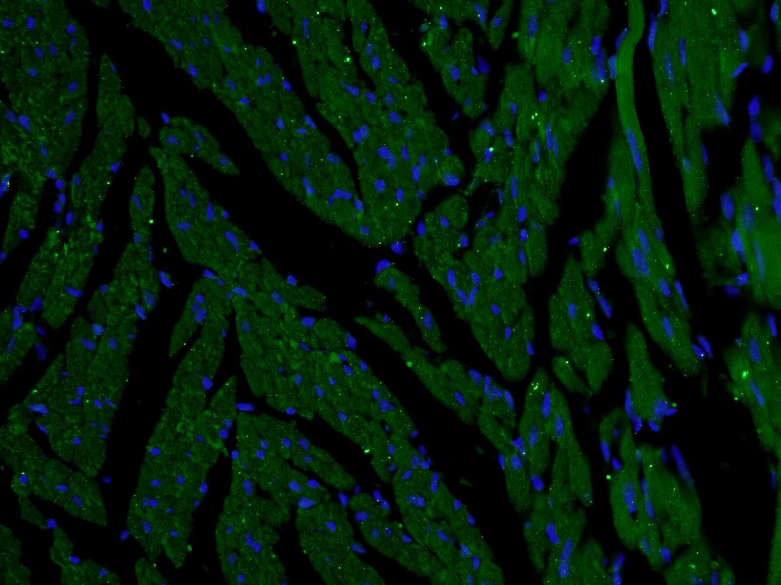 IF Staining of mouse heart using 26804-1-AP