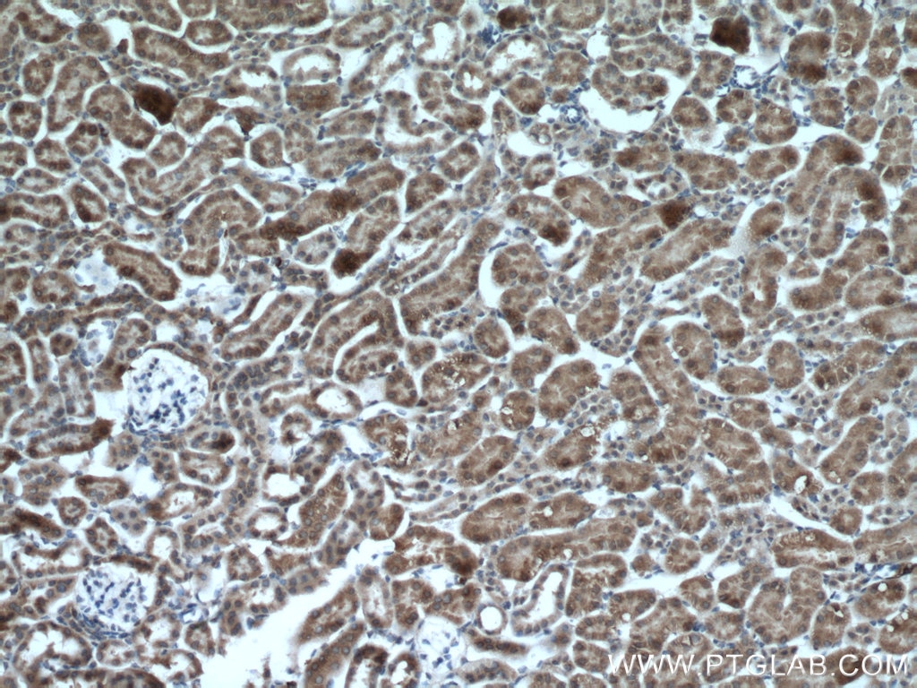 IHC staining of mouse kidney using 26804-1-AP