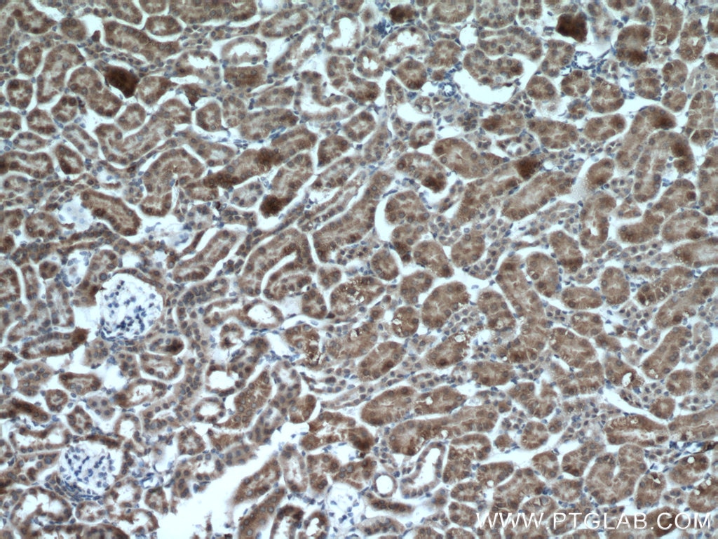 Immunohistochemistry (IHC) staining of mouse kidney tissue using SLC25A12 Polyclonal antibody (26804-1-AP)