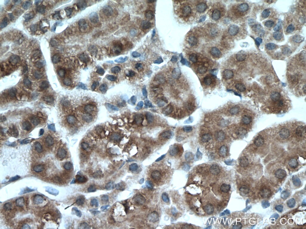 Immunohistochemistry (IHC) staining of mouse kidney tissue using SLC25A12 Polyclonal antibody (26804-1-AP)