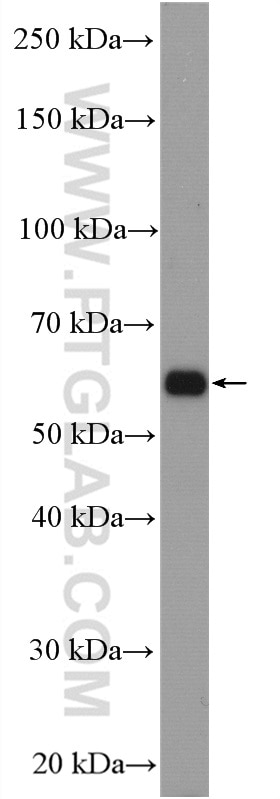 Western Blot (WB) analysis of mouse kidney tissue using SLC25A12 Polyclonal antibody (26804-1-AP)