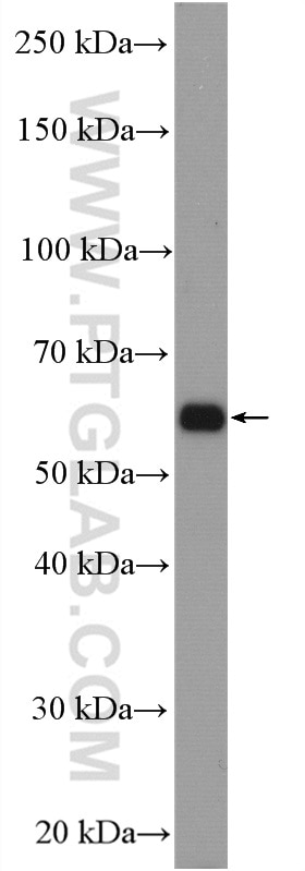 WB analysis of mouse kidney using 26804-1-AP