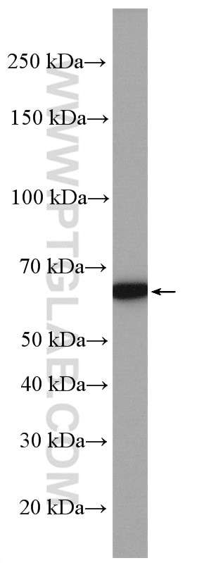 Western Blot (WB) analysis of mouse skeletal muscle tissue using SLC25A12 Polyclonal antibody (26804-1-AP)