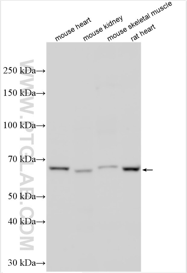 Western Blot (WB) analysis of various lysates using SLC25A12 Polyclonal antibody (26804-1-AP)