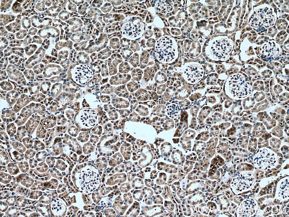 IHC staining of mouse kidney using 67467-1-Ig