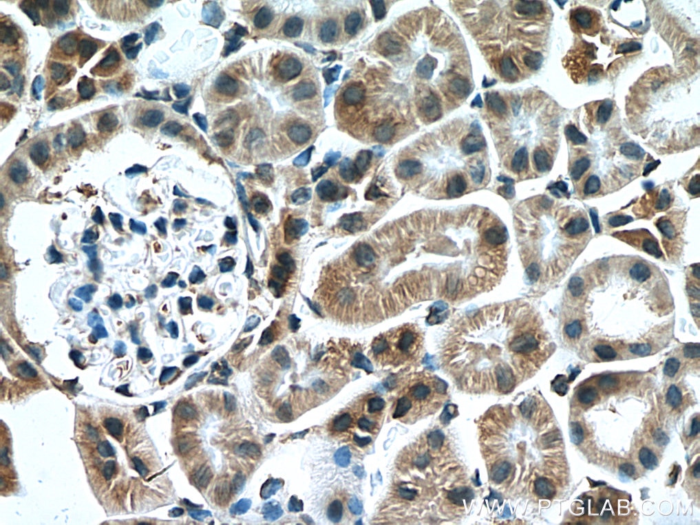 Immunohistochemistry (IHC) staining of mouse kidney tissue using SLC25A12 Monoclonal antibody (67467-1-Ig)