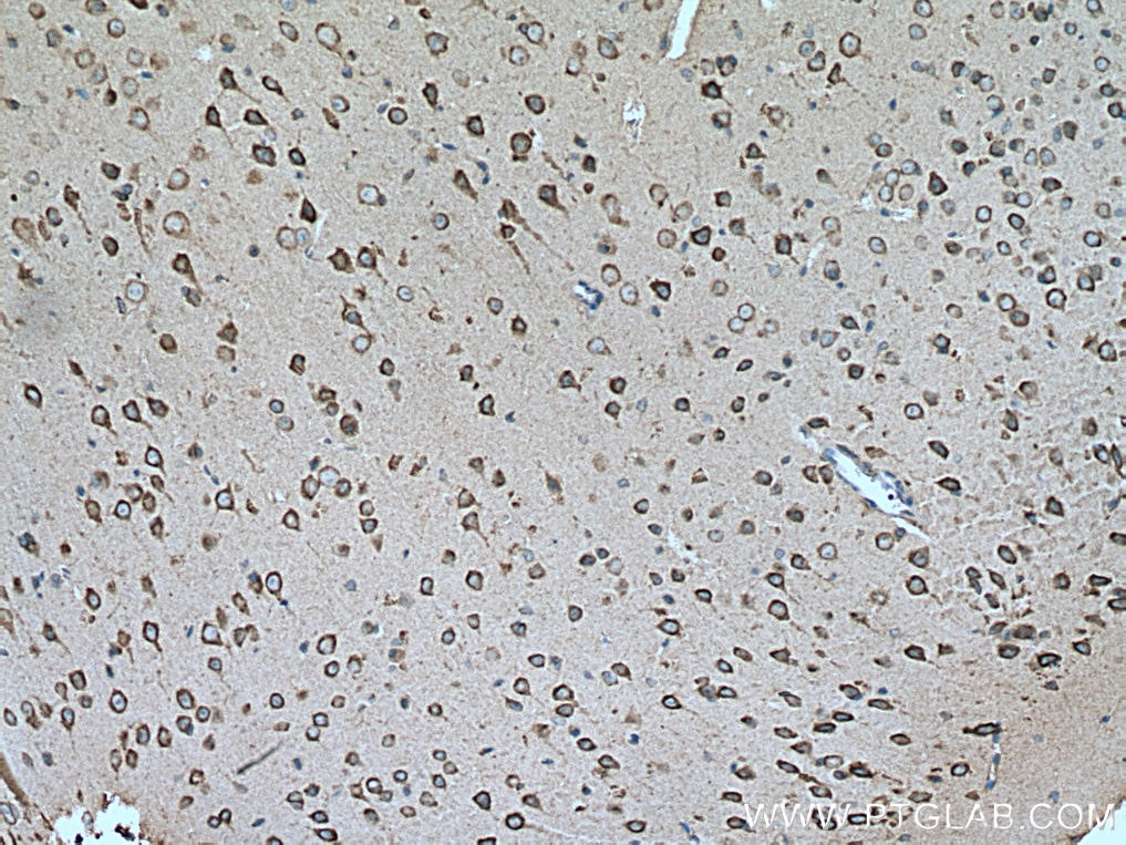Immunohistochemistry (IHC) staining of mouse brain tissue using SLC25A12 Monoclonal antibody (67467-1-Ig)