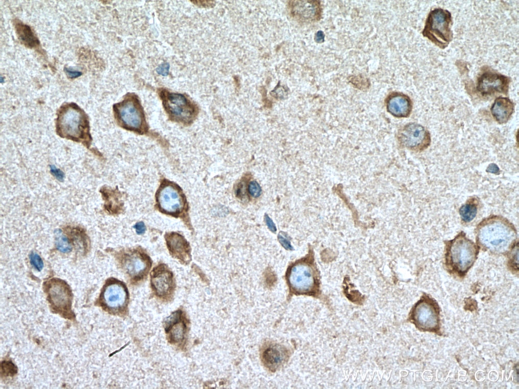 IHC staining of mouse brain using 67467-1-Ig