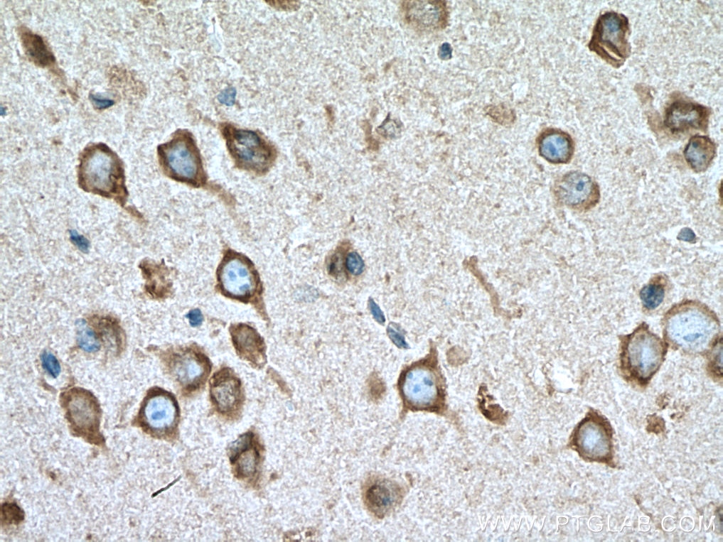 Immunohistochemistry (IHC) staining of mouse brain tissue using SLC25A12 Monoclonal antibody (67467-1-Ig)