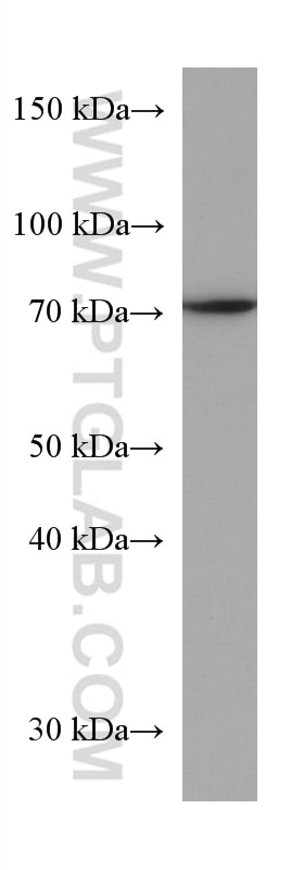 Western Blot (WB) analysis of A431 cells using SLC25A12 Monoclonal antibody (67467-1-Ig)