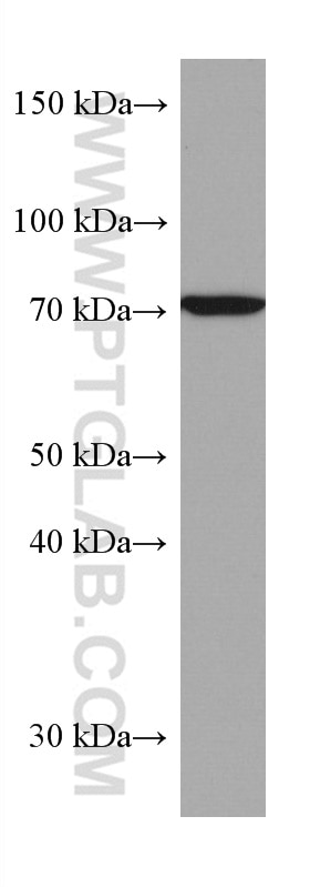 Western Blot (WB) analysis of LNCaP cells using SLC25A12 Monoclonal antibody (67467-1-Ig)