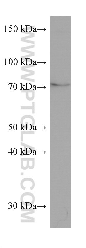 Western Blot (WB) analysis of Jurkat cells using SLC25A12 Monoclonal antibody (67467-1-Ig)