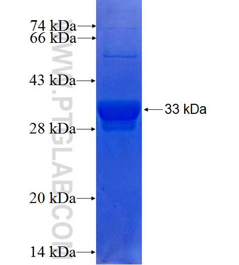 SLC25A12 fusion protein Ag25150 SDS-PAGE