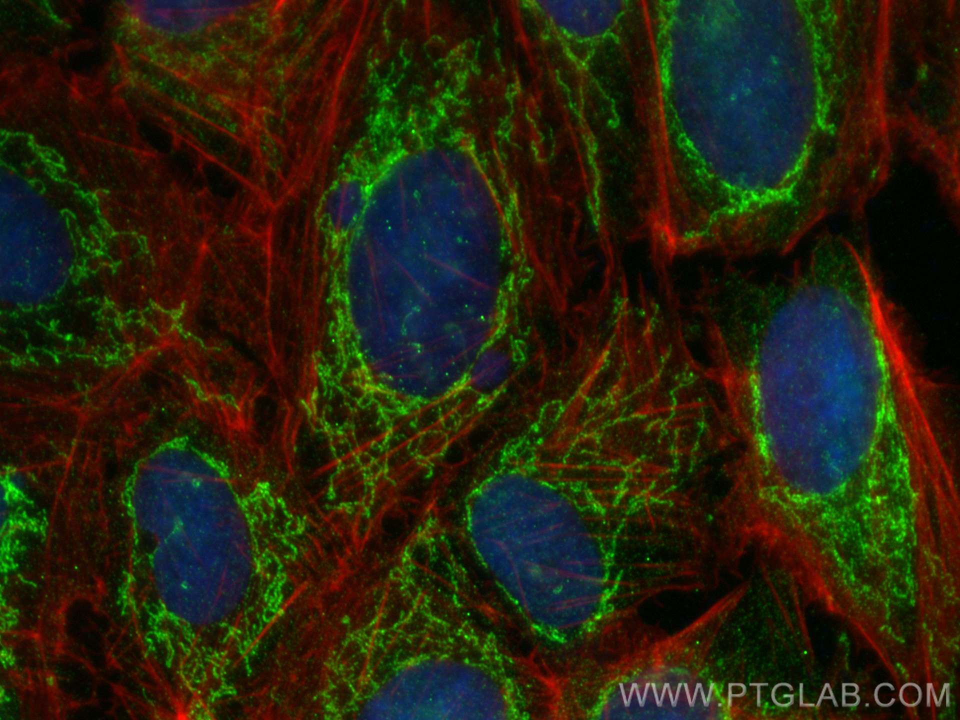 Immunofluorescence (IF) / fluorescent staining of U2OS cells using SLC25A13 Polyclonal antibody (10789-1-AP)