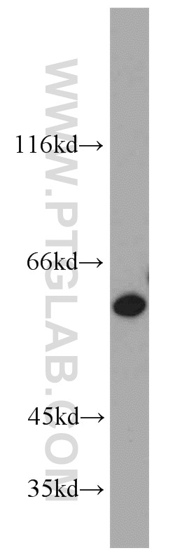 Western Blot (WB) analysis of HEK-293 cells using SLC25A13 Polyclonal antibody (10789-1-AP)