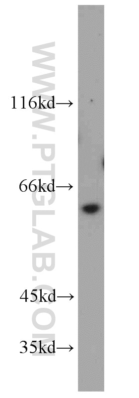 Western Blot (WB) analysis of A431 cells using SLC25A13 Polyclonal antibody (10789-1-AP)