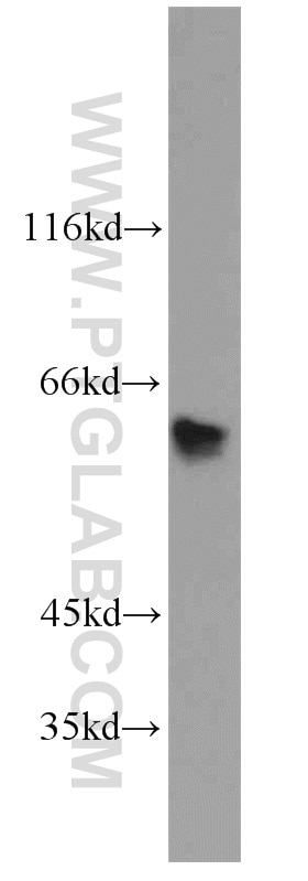 Western Blot (WB) analysis of mouse liver tissue using SLC25A13 Polyclonal antibody (10789-1-AP)