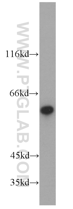 Western Blot (WB) analysis of mouse kidney tissue using SLC25A13 Polyclonal antibody (10789-1-AP)