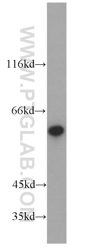 WB analysis of mouse kidney using 10789-1-AP