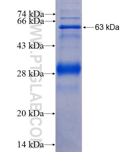 SLC25A13 fusion protein Ag1242 SDS-PAGE