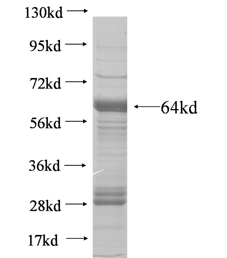 SLC25A13 fusion protein Ag5876 SDS-PAGE
