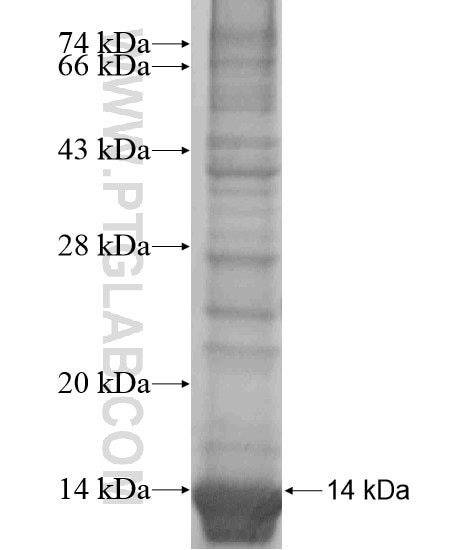 SLC25A14 fusion protein Ag18661 SDS-PAGE
