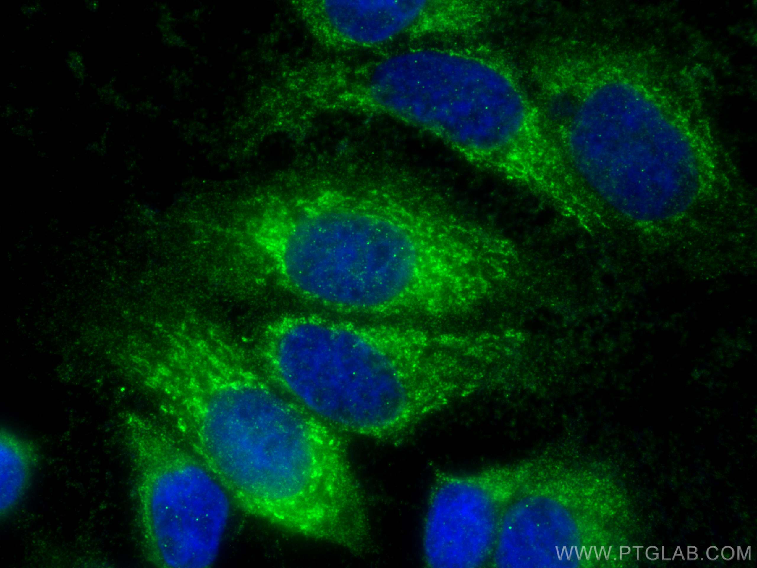 Immunofluorescence (IF) / fluorescent staining of MCF-7 cells using SLC25A15 Polyclonal antibody (15317-1-AP)