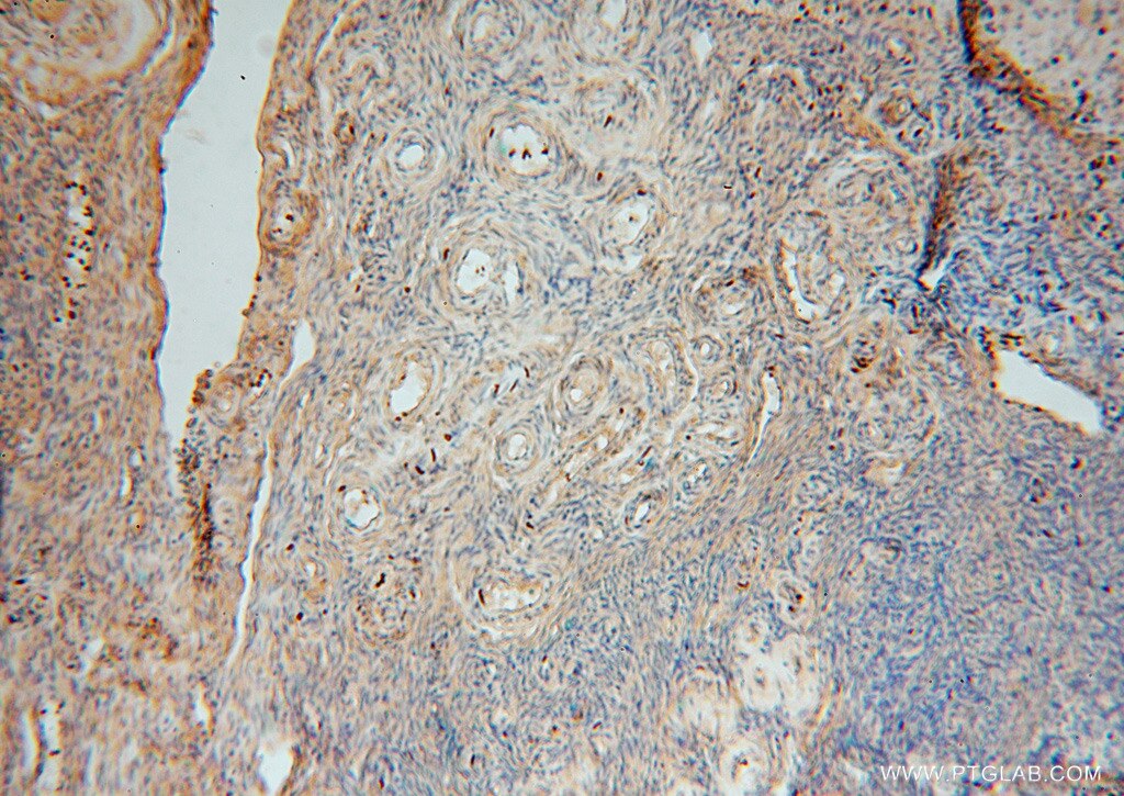 Immunohistochemistry (IHC) staining of human skin tissue using SLC25A15 Polyclonal antibody (15317-1-AP)