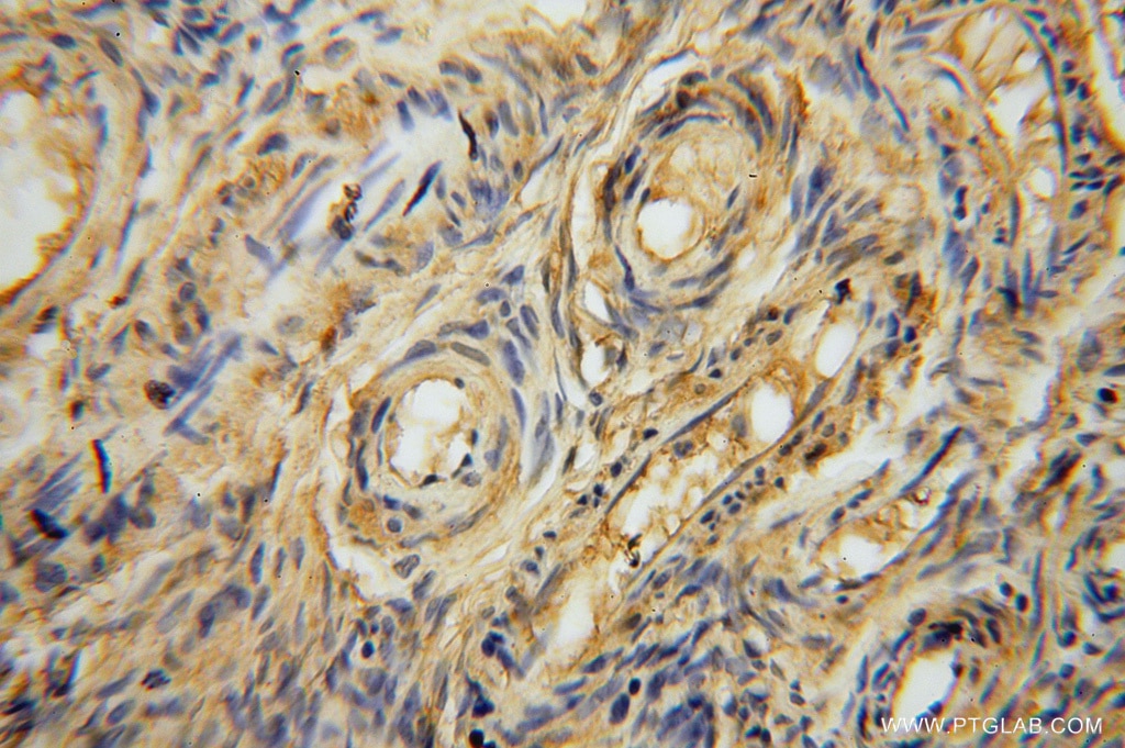 Immunohistochemistry (IHC) staining of human skin tissue using SLC25A15 Polyclonal antibody (15317-1-AP)