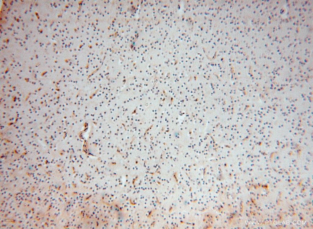 Immunohistochemistry (IHC) staining of human brain tissue using SLC25A15 Polyclonal antibody (15317-1-AP)