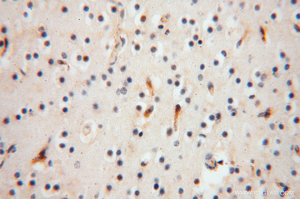 Immunohistochemistry (IHC) staining of human brain tissue using SLC25A15 Polyclonal antibody (15317-1-AP)