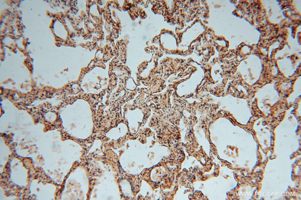 Immunohistochemistry (IHC) staining of human lung tissue using SLC25A15 Polyclonal antibody (15317-1-AP)