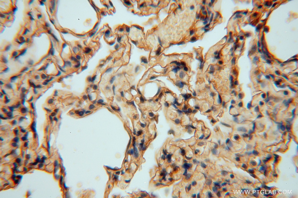 Immunohistochemistry (IHC) staining of human lung tissue using SLC25A15 Polyclonal antibody (15317-1-AP)