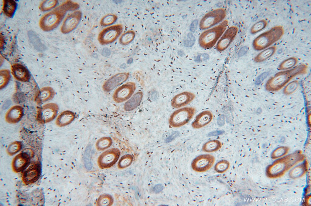 Immunohistochemistry (IHC) staining of human ovary tissue using SLC25A15 Polyclonal antibody (15317-1-AP)