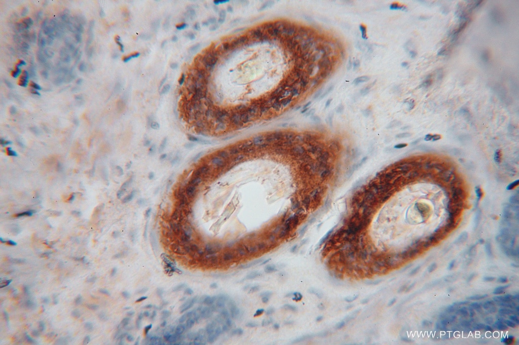 Immunohistochemistry (IHC) staining of human ovary tissue using SLC25A15 Polyclonal antibody (15317-1-AP)