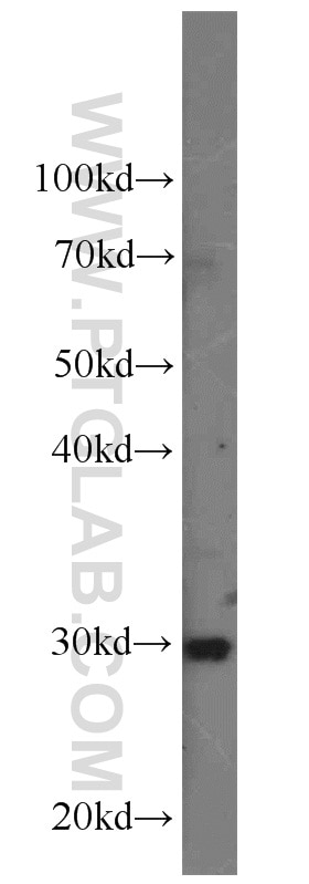 Western Blot (WB) analysis of mouse liver tissue using SLC25A15 Polyclonal antibody (15317-1-AP)