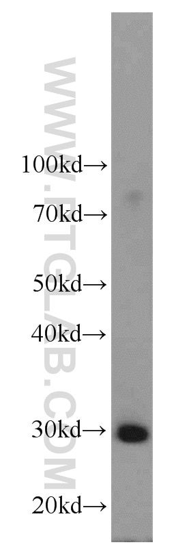 Western Blot (WB) analysis of mouse stomach tissue using SLC25A15 Polyclonal antibody (15317-1-AP)