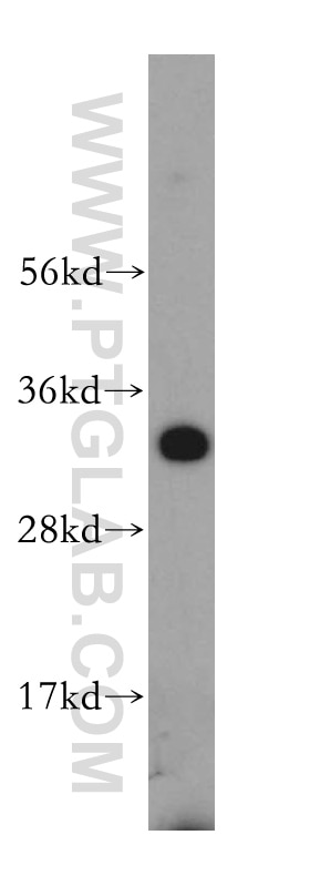 Western Blot (WB) analysis of HeLa cells using SLC25A15 Polyclonal antibody (15317-1-AP)