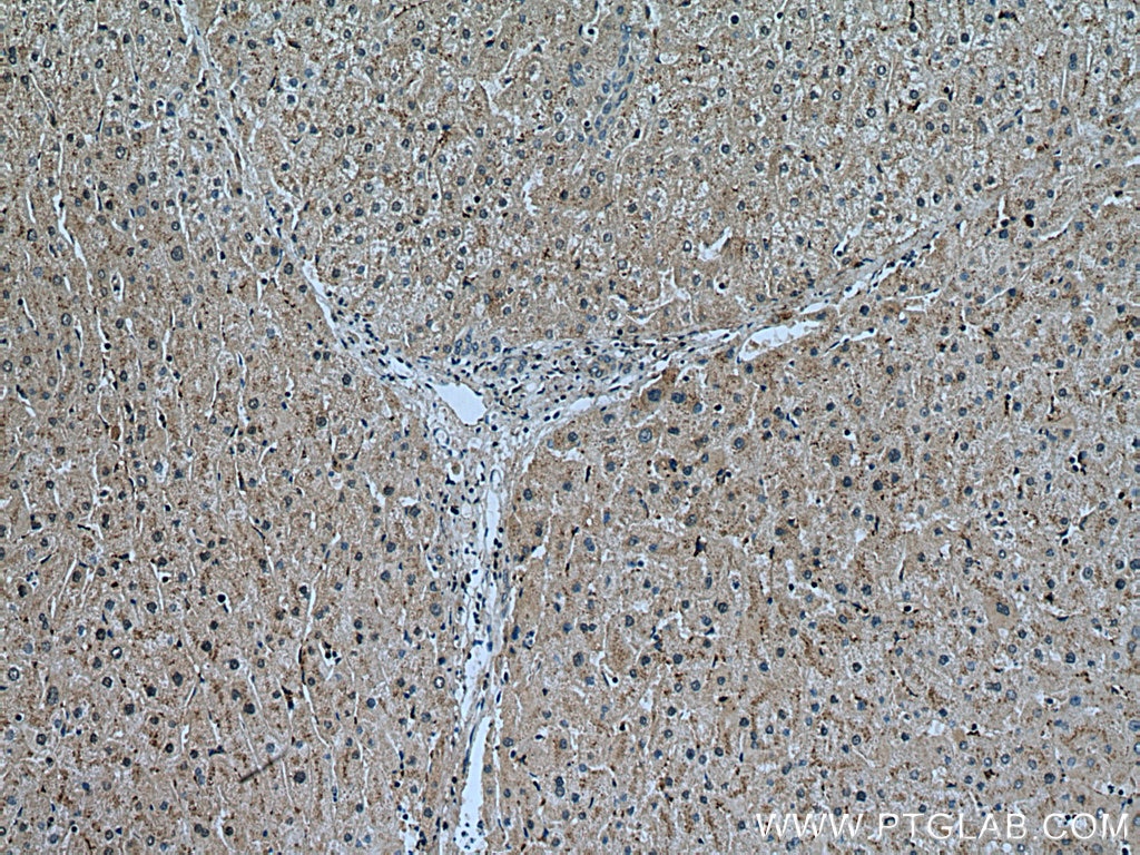 Immunohistochemistry (IHC) staining of human liver tissue using SLC25A17 Monoclonal antibody (67635-1-Ig)