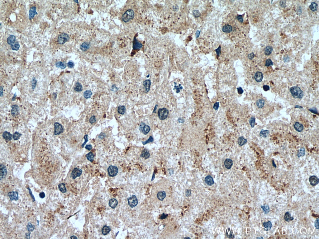 Immunohistochemistry (IHC) staining of human liver tissue using SLC25A17 Monoclonal antibody (67635-1-Ig)