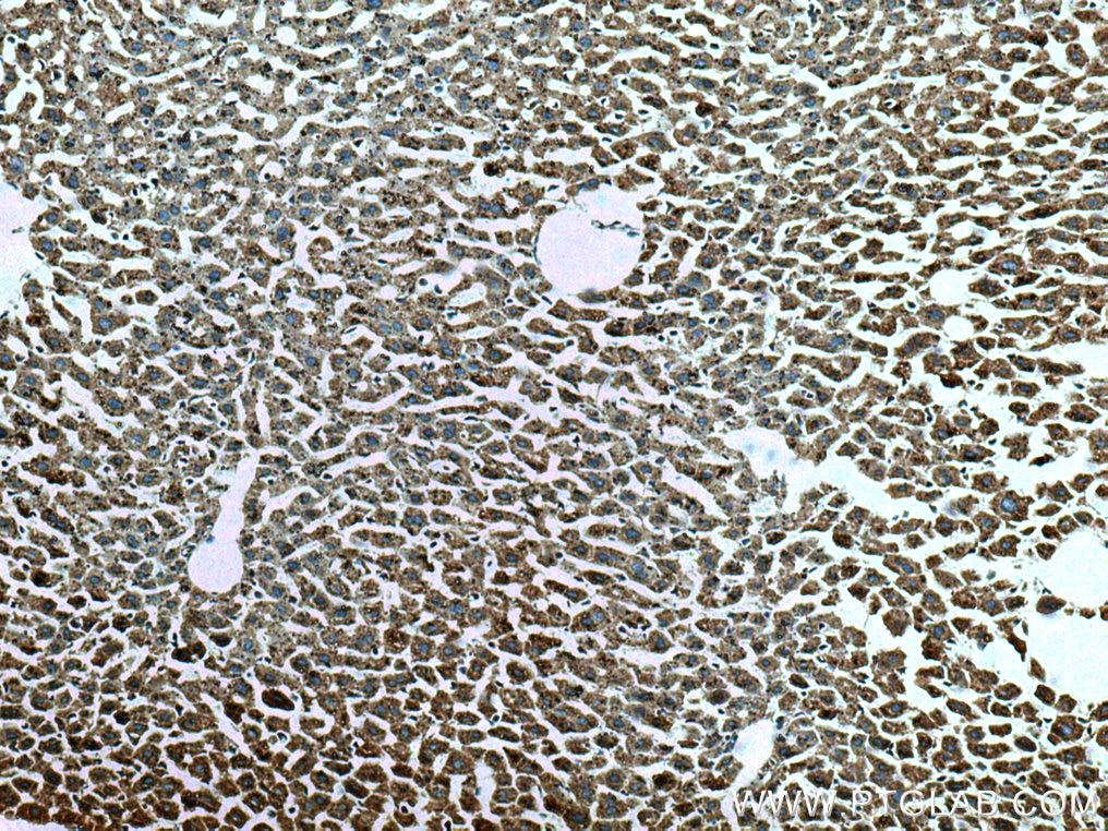 Immunohistochemistry (IHC) staining of mouse liver tissue using SLC25A17 Monoclonal antibody (67635-1-Ig)