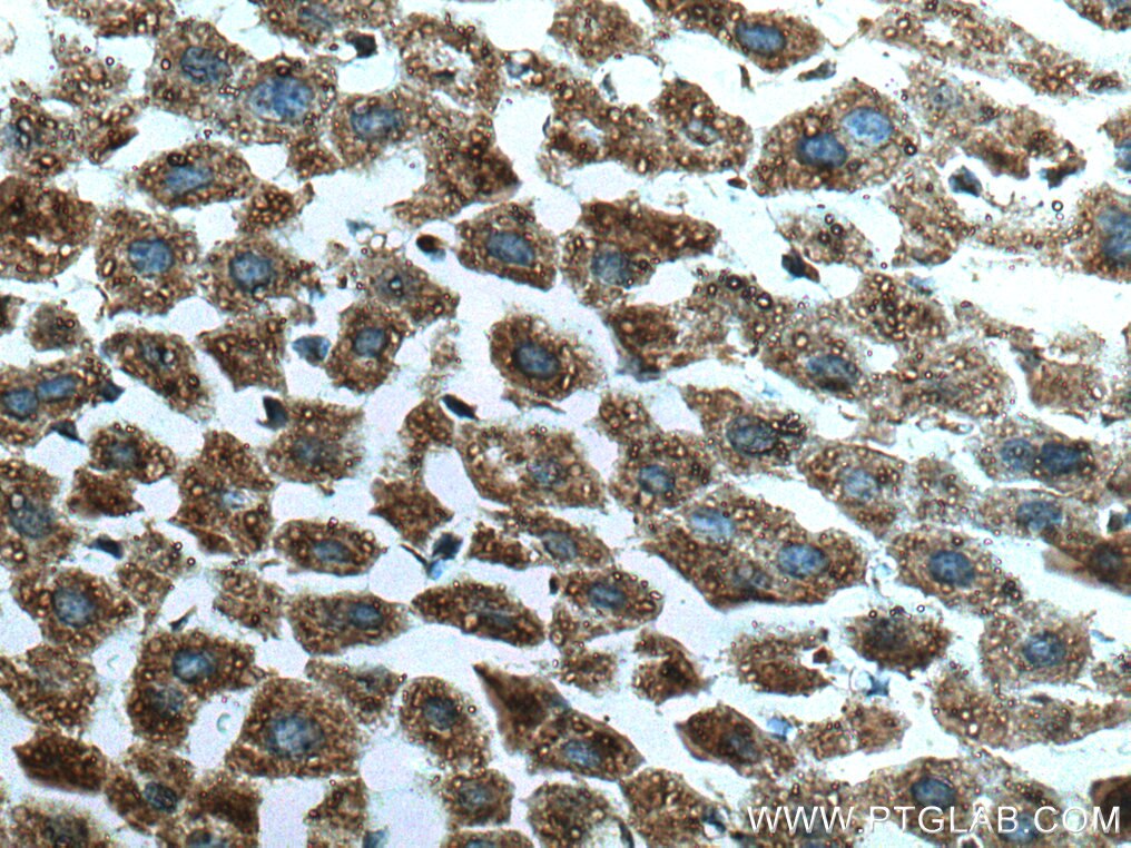 Immunohistochemistry (IHC) staining of mouse liver tissue using SLC25A17 Monoclonal antibody (67635-1-Ig)