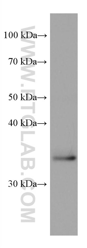 Western Blot (WB) analysis of U2OS cells using SLC25A17 Monoclonal antibody (67635-1-Ig)