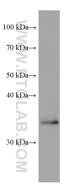 WB analysis of U2OS using 67635-1-Ig