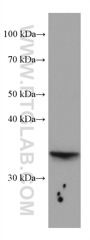 Western Blot (WB) analysis of A549 cells using SLC25A17 Monoclonal antibody (67635-1-Ig)